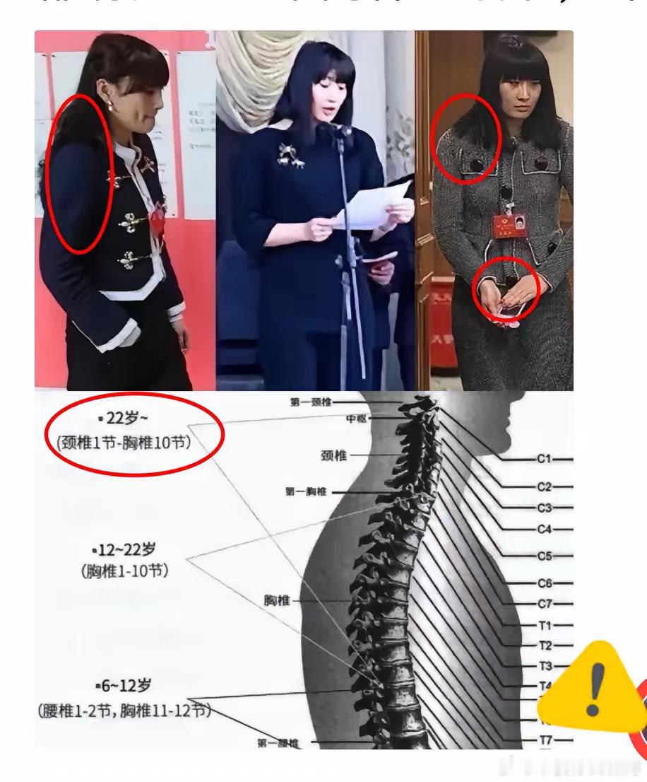宗大小姐早已出卖了她的身体，背总是弯的，总是驼的，参