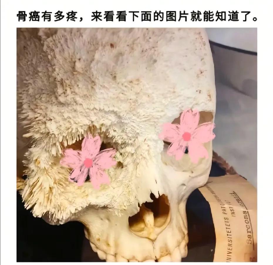 引无数人驻足:骨癌到底多疼，看看你就知道了!所以你平时有没有长期压力大或情绪不好