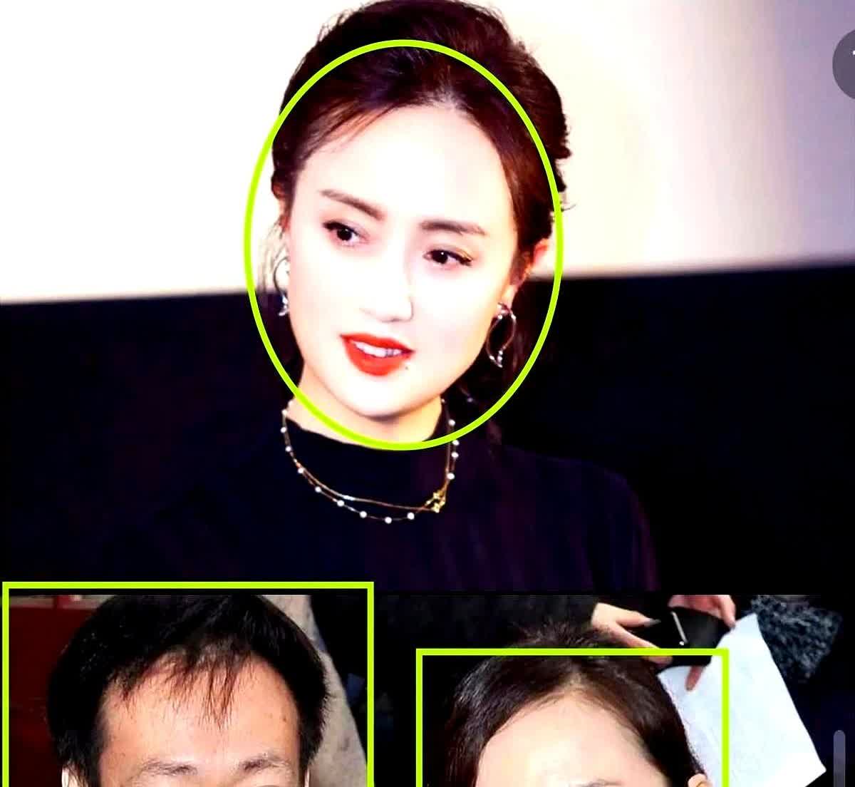 终于知道朱媛媛为什么得癌症了？不是她饮食习惯不好，也不是她经常熬夜，更不