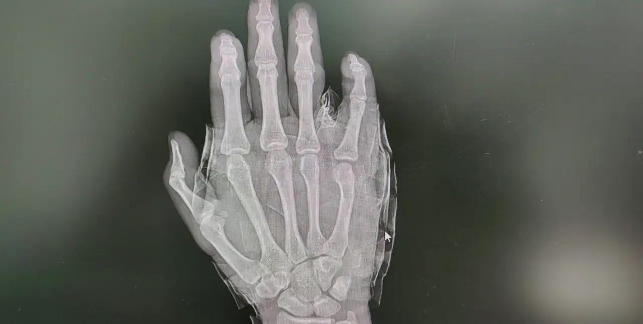 不要生气！不要生气！不要生气！重要的事说三遍！真心奉劝那些家里有小学生的家长