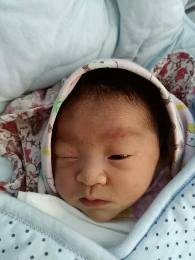 唐筛临界风险, 没做穿刺生个女宝, 开始丑得像猴子, 现在长成这样