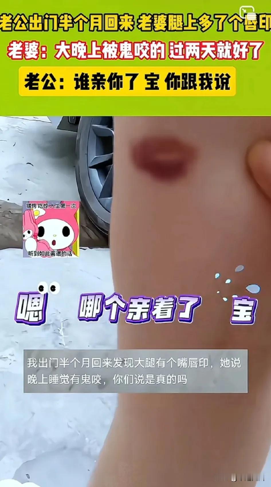 “这是哪个亲的？宝！”老婆：“大晚上被鬼咬了，过两天就好了！”老公出门半个月