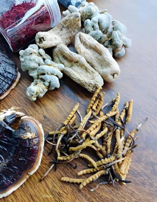 胆结石：我30年临床常用的“通胆化石方”，助众多患者免遭手术之苦！ 我行医3