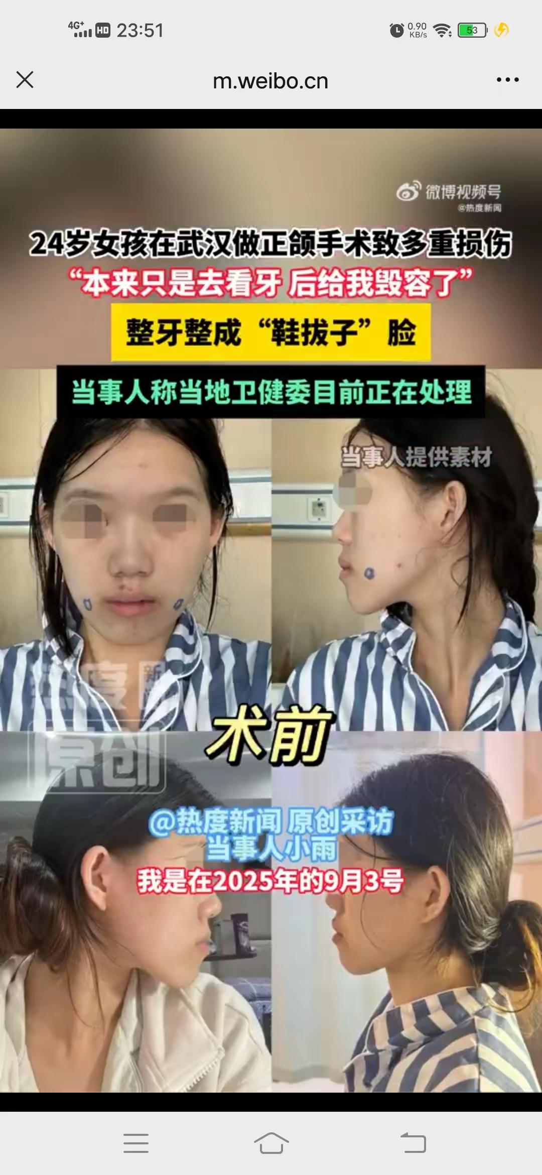 武汉那个小雨姑娘，真是倒了血霉，本来就想补个牙种个牙，最多正畸一下，结果武大口腔