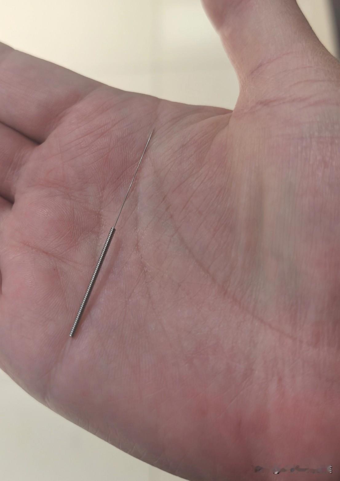 女邻居昨天非带我去做针灸，说多被这个老中医扎扎，绝对管用。确实管用！当天晚上我