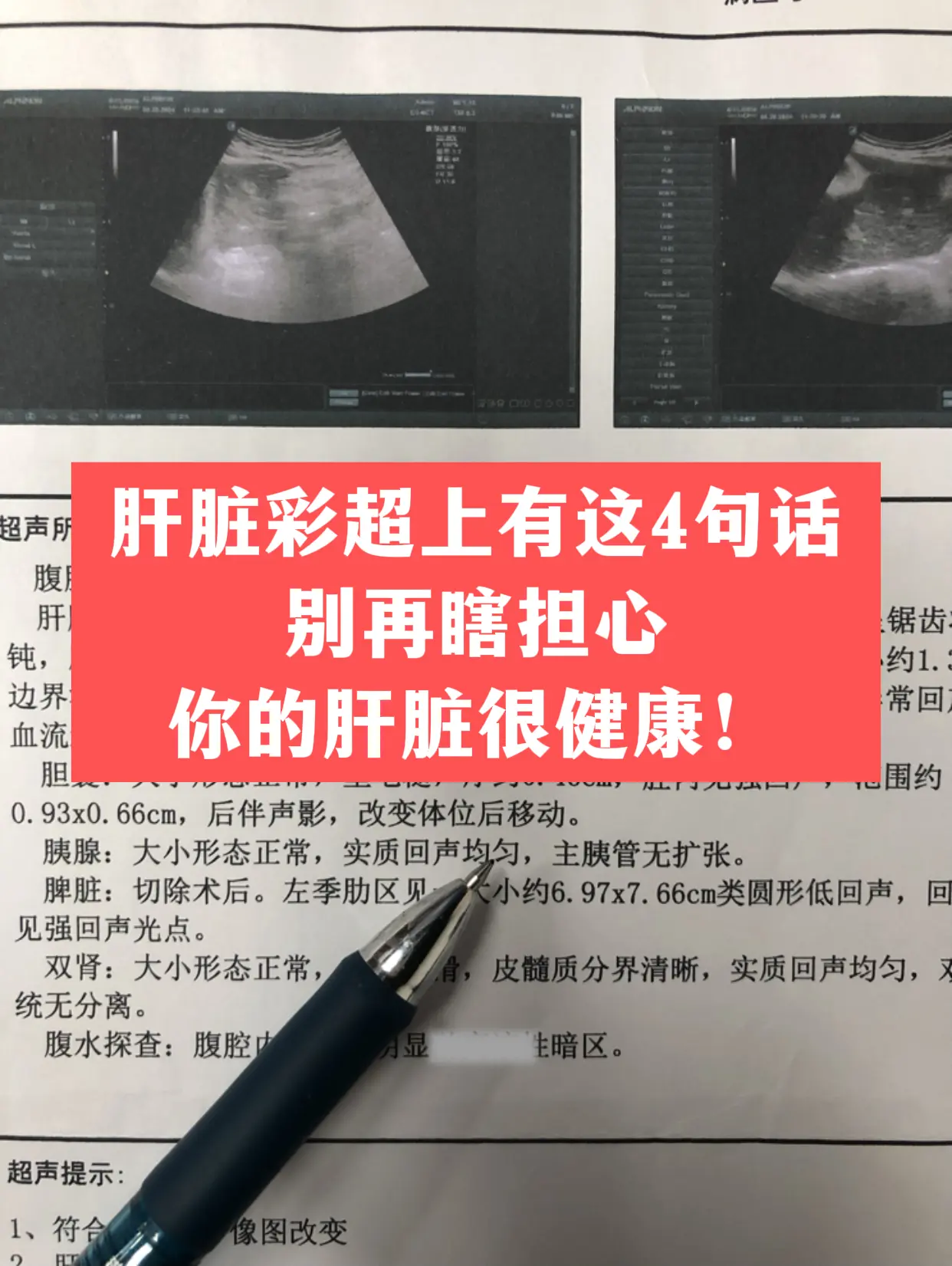 肝脏彩超上有这 4 句话，别再瞎担心！。1. 肝脏大小形态正常  2....