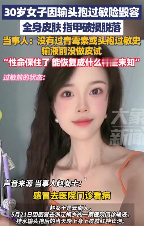 “心疼”！5月21日，浙江一个30岁的姑娘感冒去诊所，挂了头孢。她说自己没过敏史