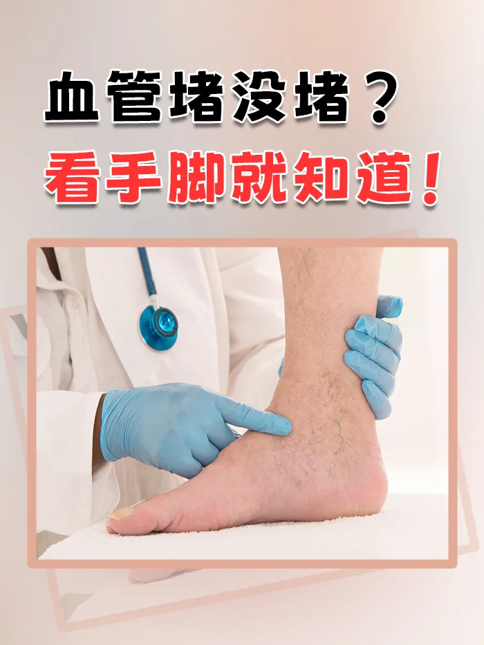 血管堵没堵？看手脚就知道！