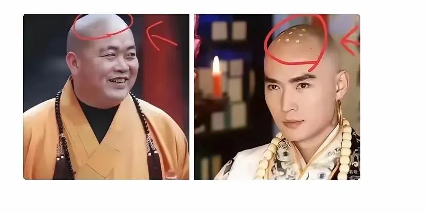“戒疤”这玩意儿，1983年12月的中国佛教协会理事扩大会议上一锤定音：以后谁也