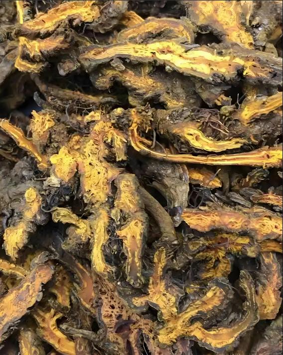 多囊肾不必忧，一方通调脏腑、益气血，30余载临床验证颇有效！前年深秋，一位