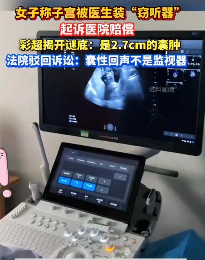 2016年，辽宁一50岁女子去医院取避孕环，几年后，她用手机播放歌曲时，发现医生