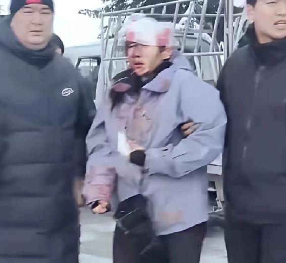 新疆女游客被雪豹咬伤脸，被救捂住脸时，手套上、头发上一大片鲜血血迹，包扎后露出脸