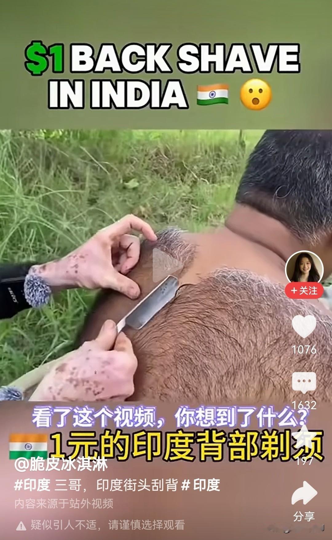 瞅瞅，印度人背部这体毛也太旺盛了，不可思议！估计蚊子见了都无从下嘴，活脱脱像穿了