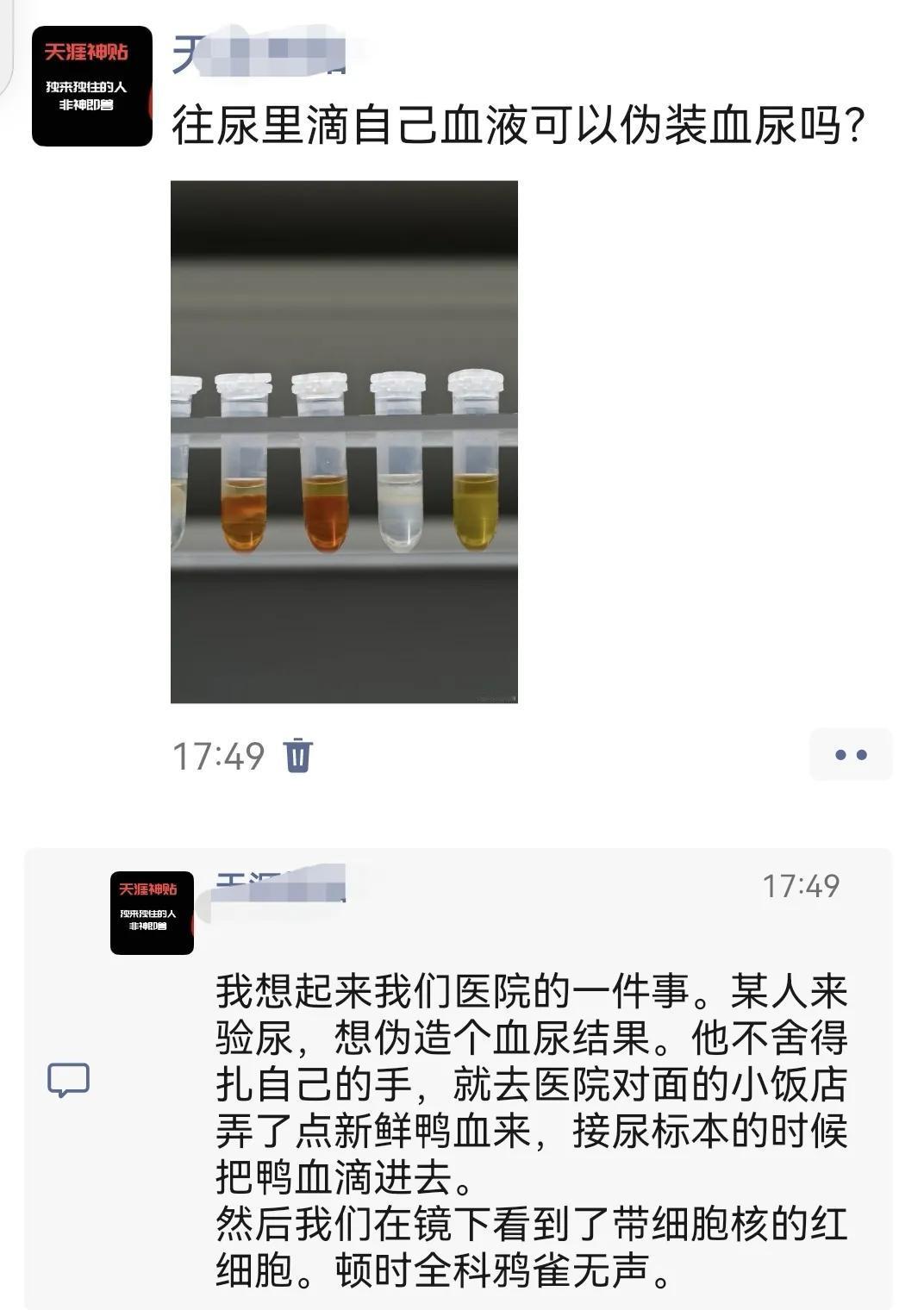往自己的尿里滴血能伪装血尿吗？