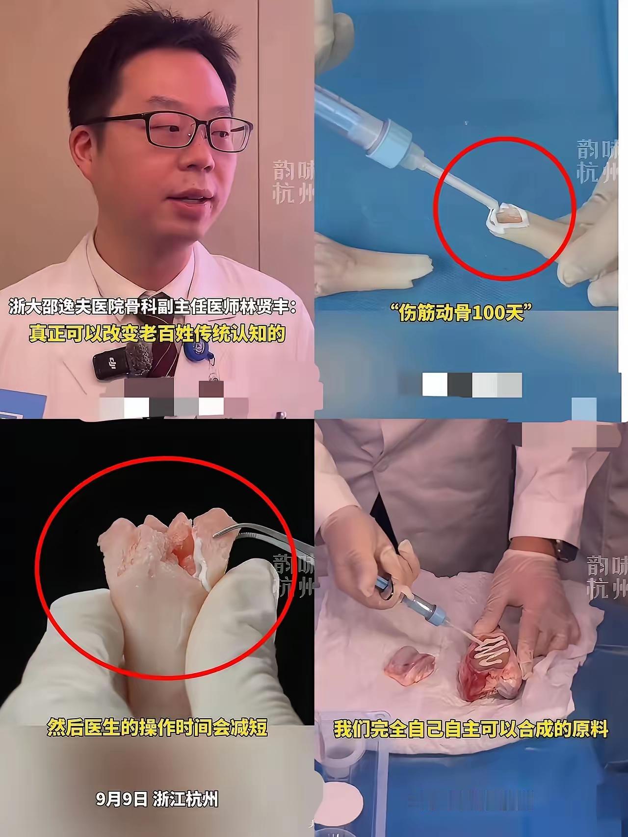 中国医疗又出王炸了！！！这次直接把全世界都给惊到了！​​​​​​​之前骨折碎