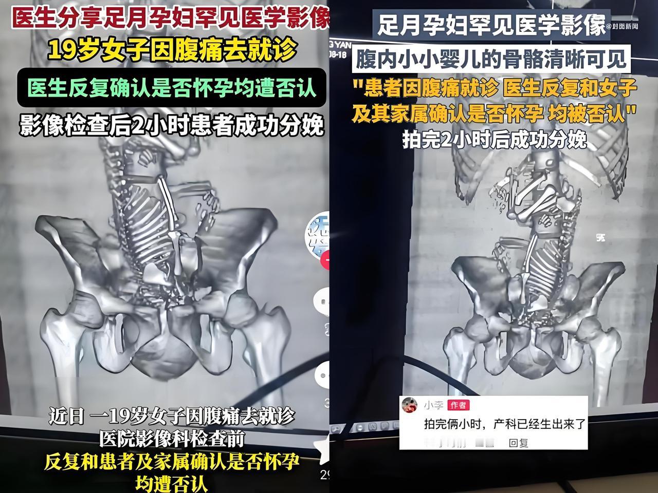 遇到一个玄学上的事简直太离谱了……19岁的小姑娘，肚子疼的厉害，去医院检