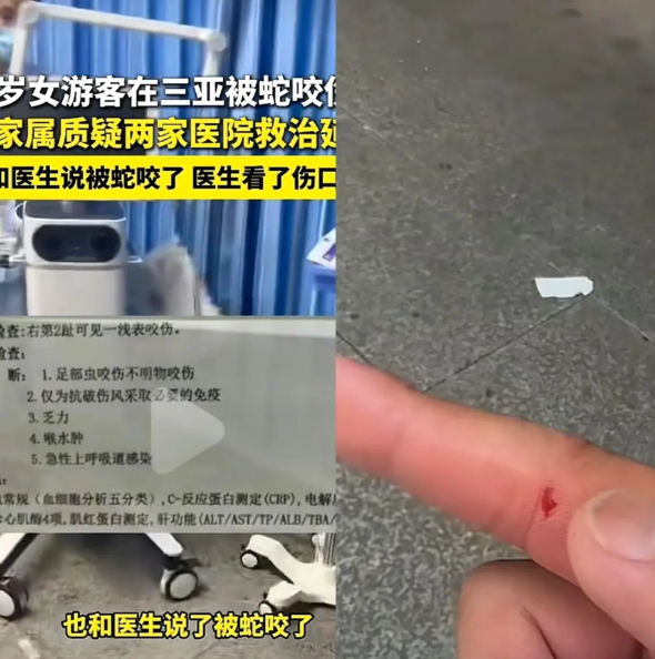 大家别骂三亚接诊被蛇咬的女子的医生了我看完了科普野生动物救助志愿者啊宝的视频后