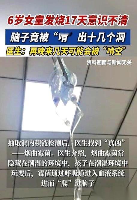 我的天，一个6岁小姑娘，脑子被啃出了十几个洞。医生说再晚两天，整个脑子就没了。