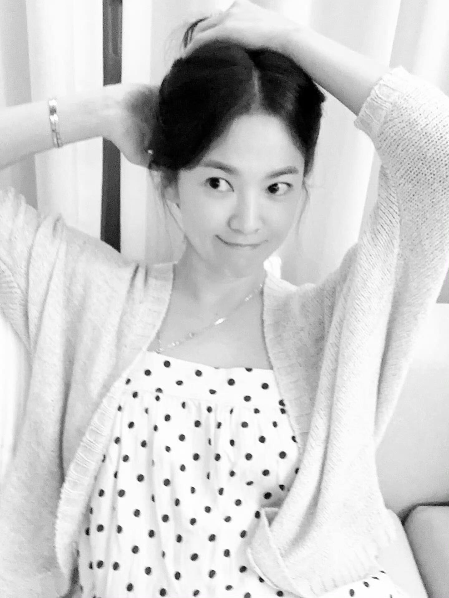 宋慧乔头发什么时候能长呢。