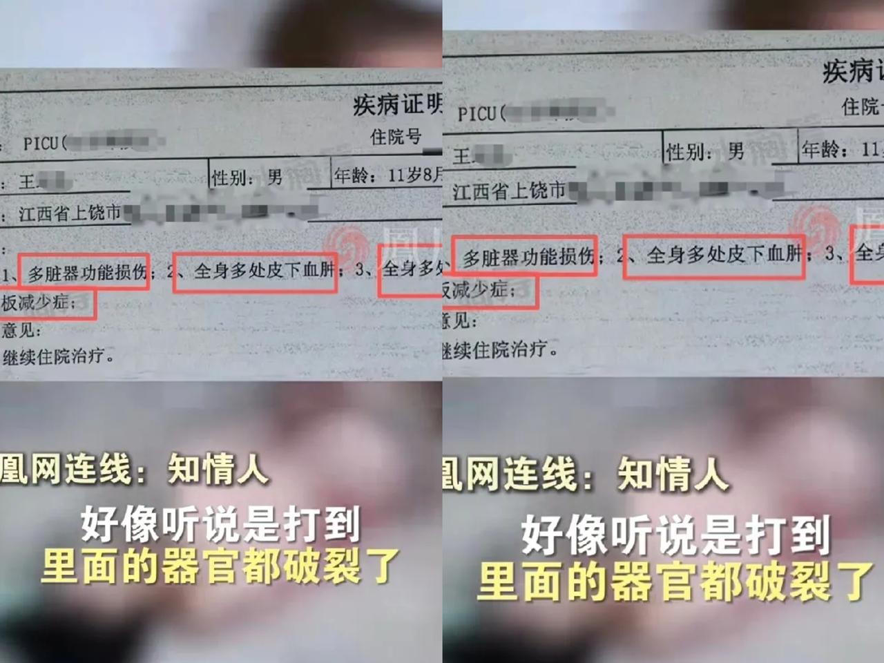 谁能想到11岁孩子说的“我想回家”会是躺在ICU里用尽全身力气的求救？就