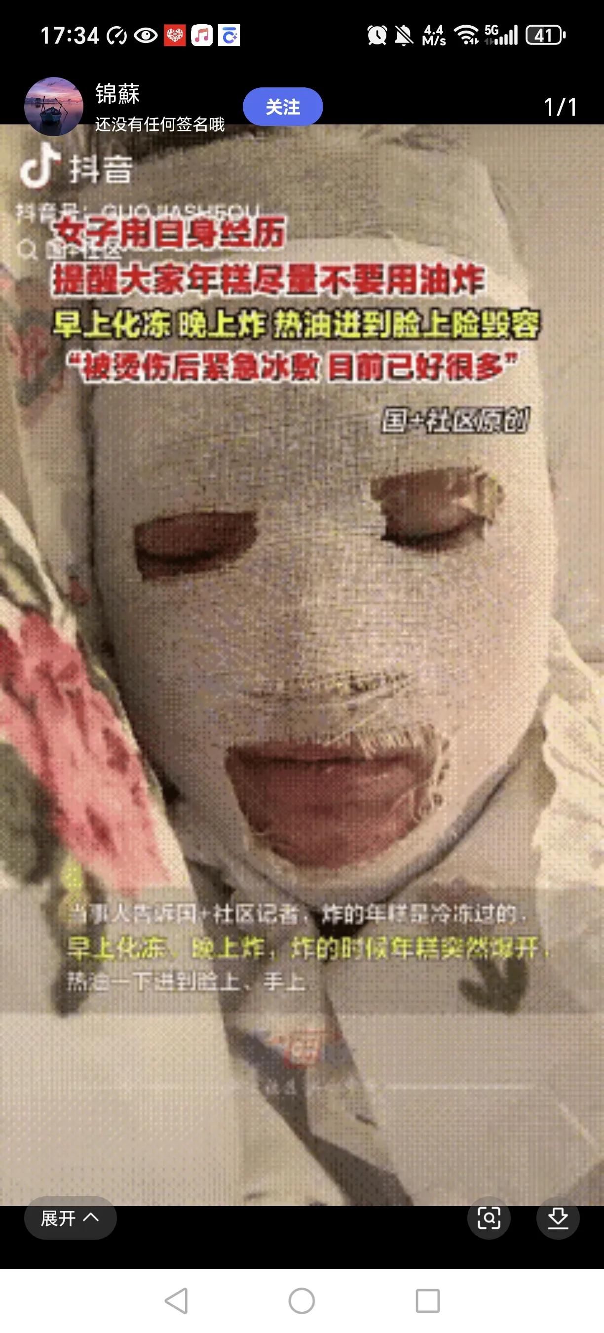 安徽女子炸年糕遭“热油炸弹”！脸手被烫起泡住院，网友吵翻：是操作错还是年糕有问题