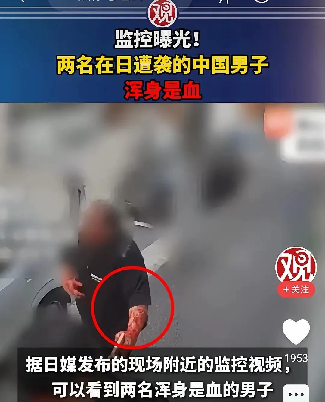 日本U型锁杀疯了！上半年第29起中国人遇伤害事件！胡锡进、马方、黄教授出来反思了