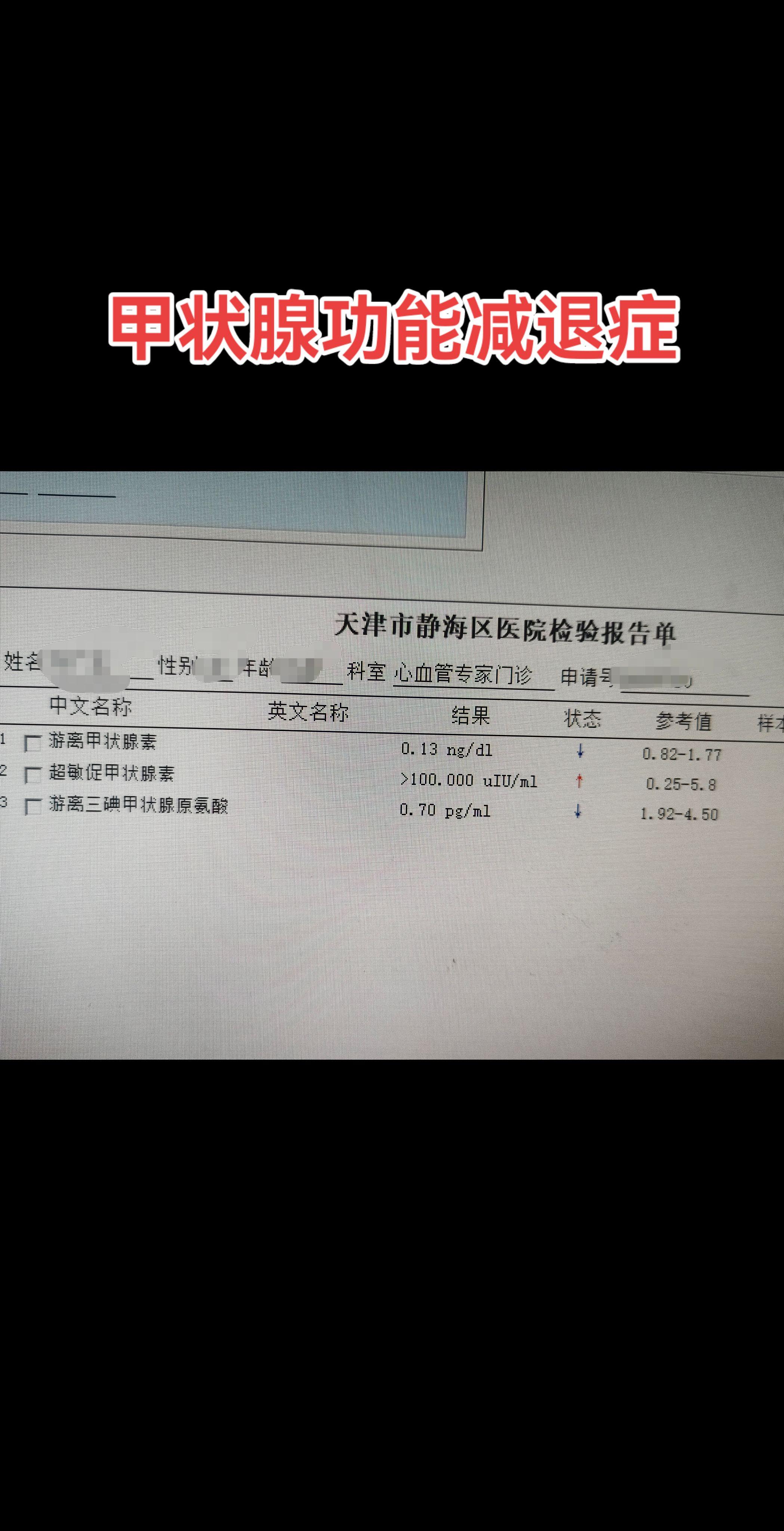 甲状腺功能减退症。患者为老年人，患有20余年甲状腺功能减退症，平时服用...