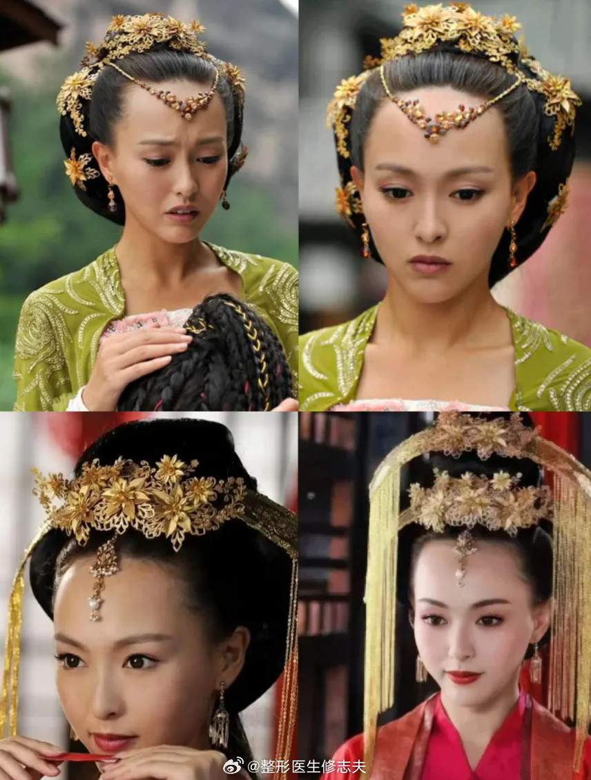 你们说发际线高对颜值影响大不大？​​​