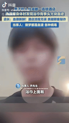 “离谱得很！”10月9日，小伙入住成都一家酒店，不料洗完澡拿浴巾擦身体，却发现毛