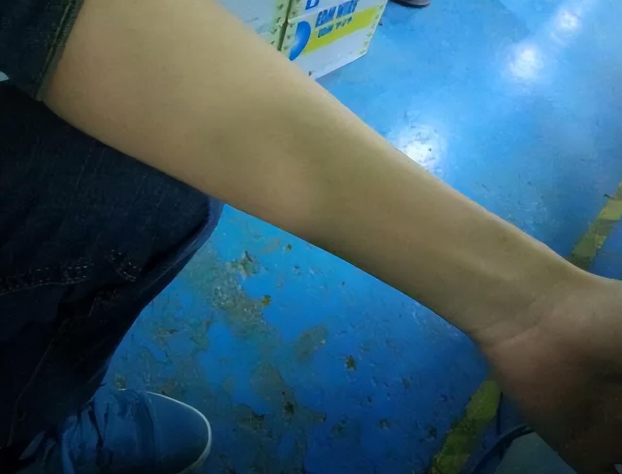 年过50岁，一定要注意手臂粗细！越来越瘦的人，或患了这2大疾病过了50岁，手