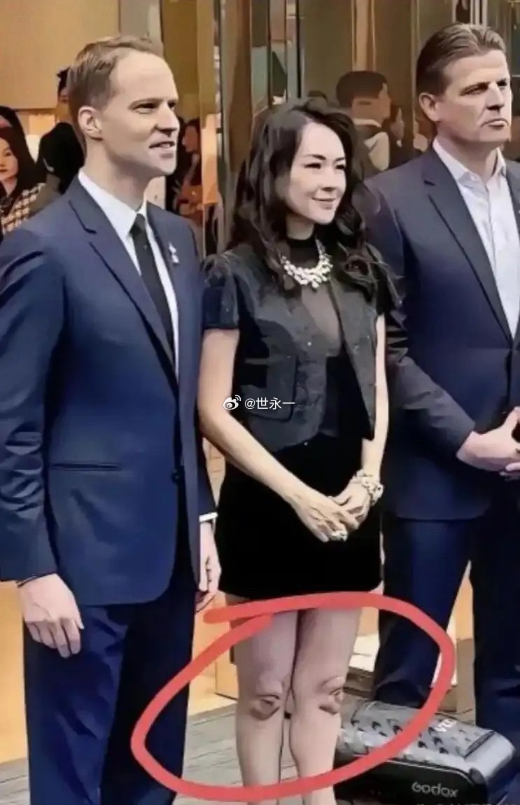 章子怡究竟是经历了什么？膝盖成这种状态了