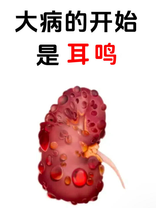 耳鸣的真相：病根不在耳朵本身 - 耳鸣，并非只是耳朵里无端响起嗡嗡声...