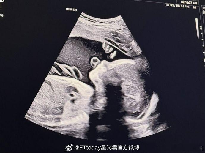 宋承炫老婆怀孕哇塞~