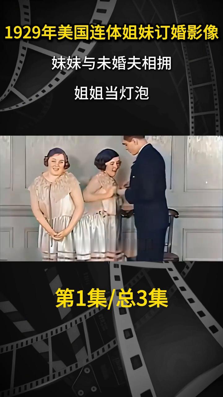 1929年美国连体姐妹订婚影像，妹妹与未婚夫相拥，姐姐当灯泡。这是1929年美