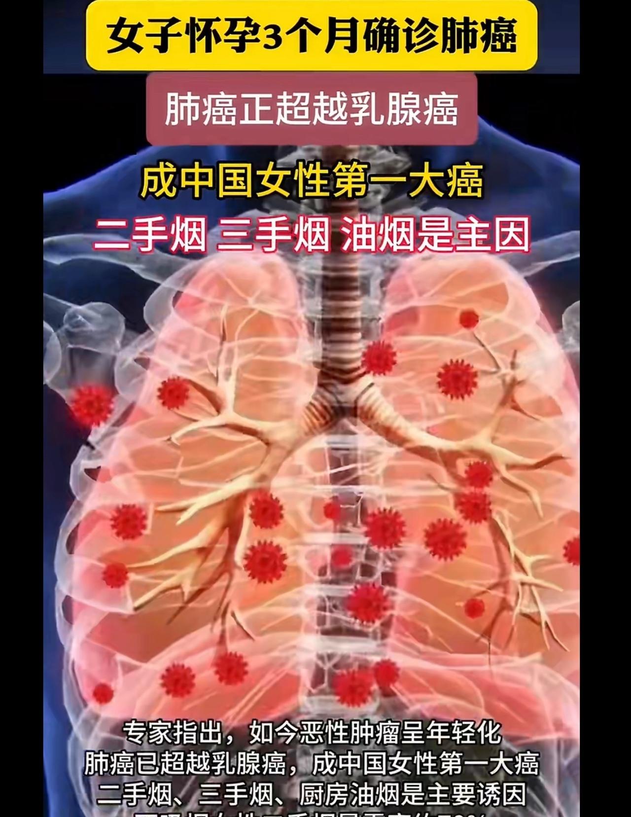 武汉一名35岁女子怀孕6个月时因严重呼吸困难急送医院，一纸检查单无情宣告其已进入