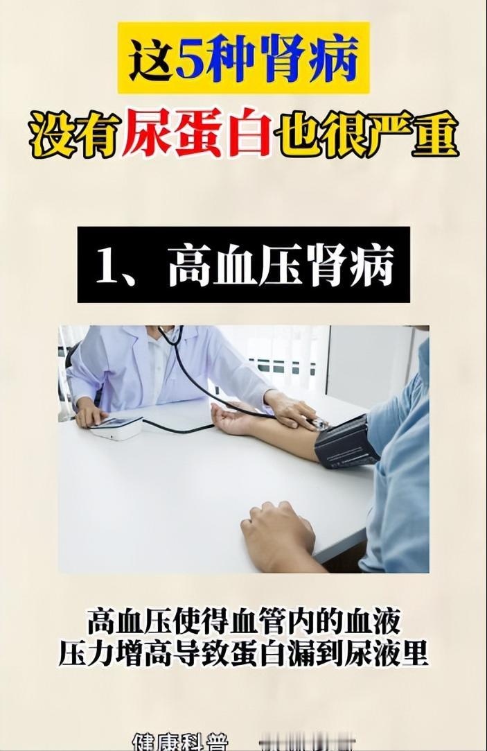 这5种肾病表现，没有尿蛋白也很严重~