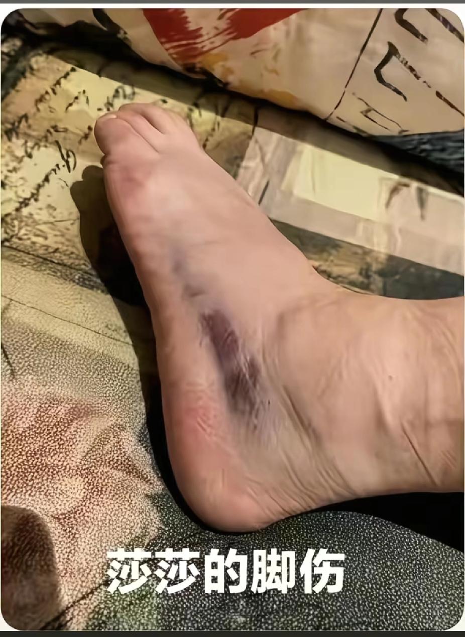 不光是我想不通估计很多人都想不通，看着莎莎脚踝上的黑青，说实话，心里真不是滋味