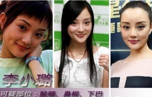 李小璐晒素颜自拍照, 却无意间暴露了自己整容的痕迹?