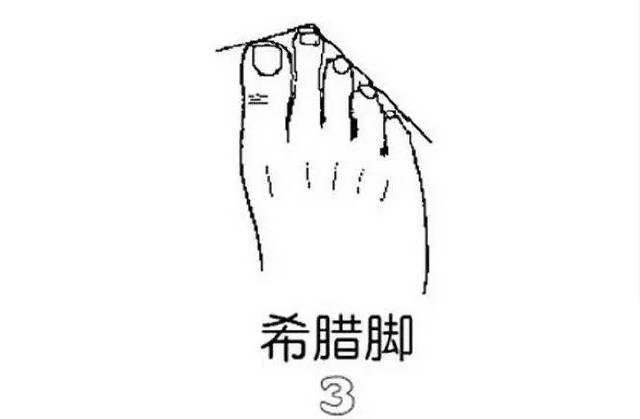 脚型三:希腊脚 脚型特征:第二根脚趾比其他四趾长.