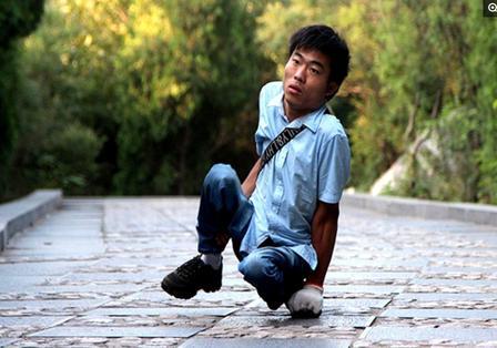 “我现在不考虑娶媳妇了！”河南商丘36岁苦命男子，跟自身顽疾死磕20年硬