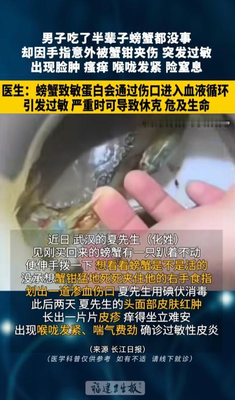 “万万没想到！”7月25日报道，湖北武汉，一男子买了螃蟹回家，发现有一只不动弹了