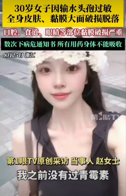 太吓人了！女生感冒到医院挂点滴，医生给开了头孢，女子感觉打完后头很痛，护士表示正