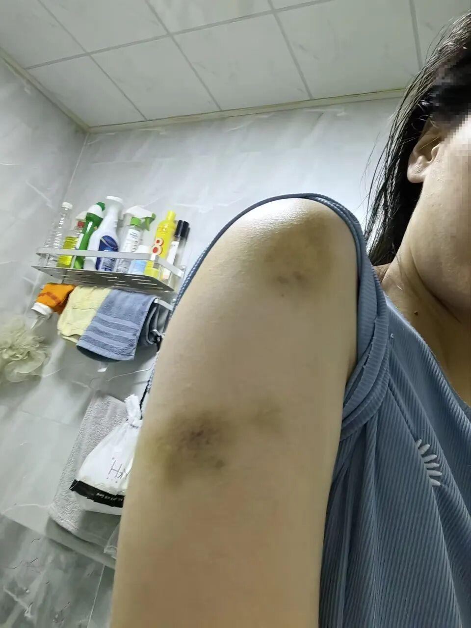 “不要赔偿，就要他得到应有的惩罚！”：女护士父亲在女儿手机发现20多张被虐自拍照