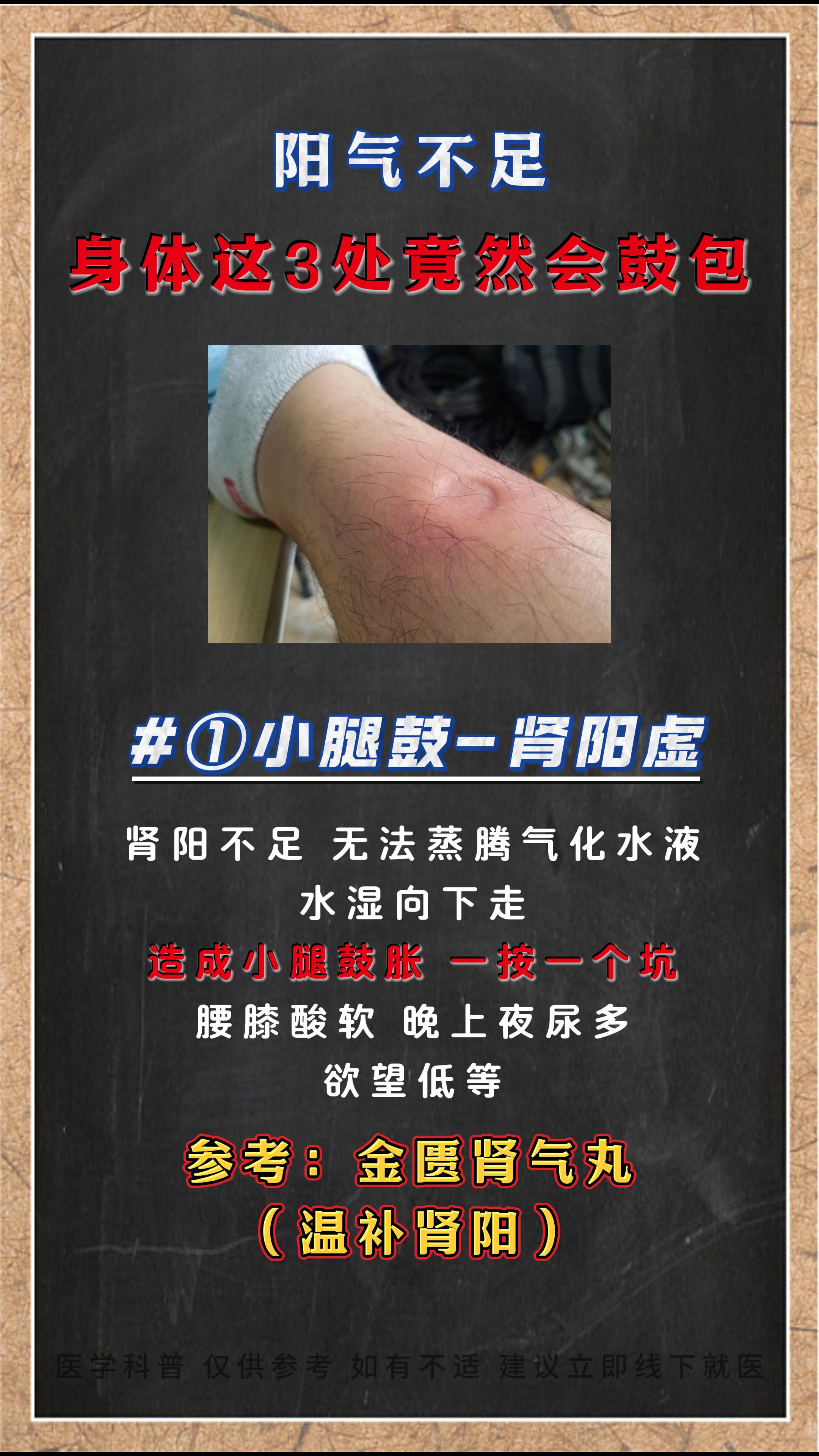 阳气不足，身体这4出会出问题。