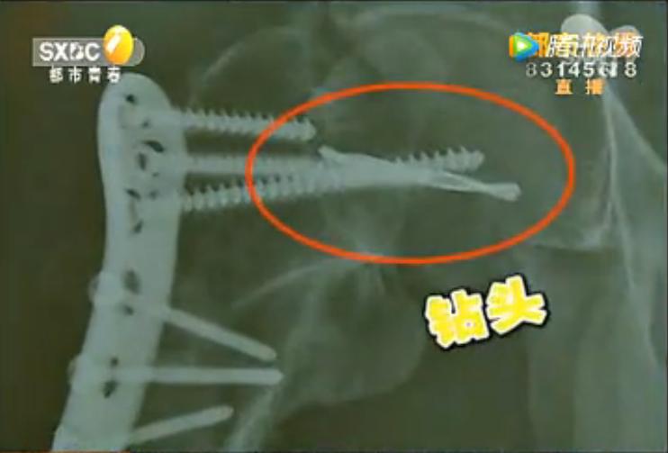 站在医院管理层面，如此低的罚款难以起到足够的震慑作用。医院作为救死扶伤的场所，本