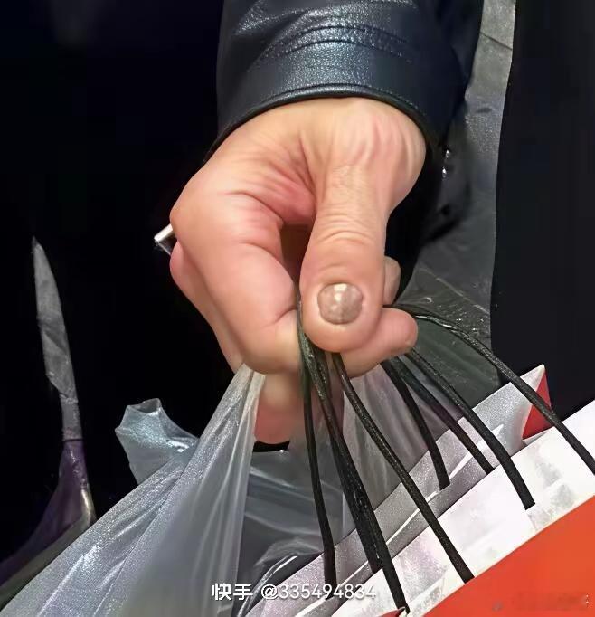 黄仁勋指甲网友结合指甲“变色、增厚、粗糙”的表现，推测为真菌感染引起的灰指甲。有