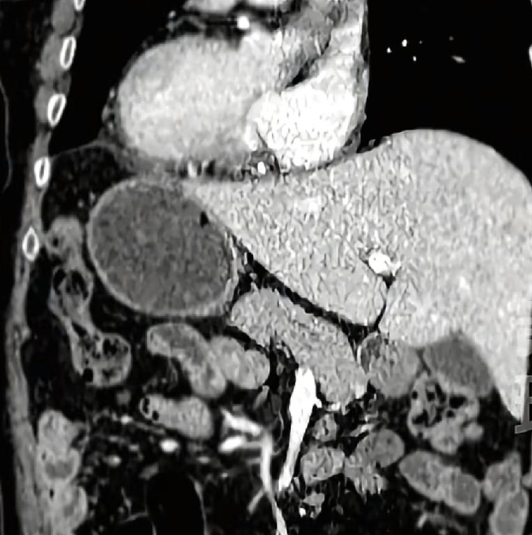 难道世界上真的有这样的人？不见一位男子，自己感觉身体不舒服，于是就去做了检查，