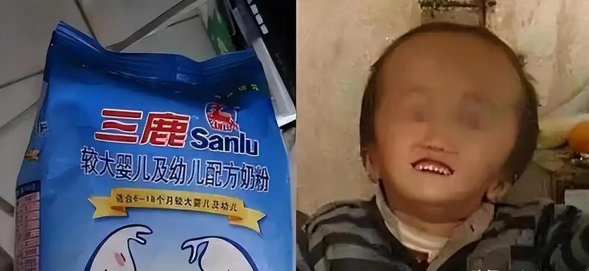很多人都搞错了！当年头大浮肿的大头娃娃，祸根是2003年阜阳劣质假奶粉，和三鹿无