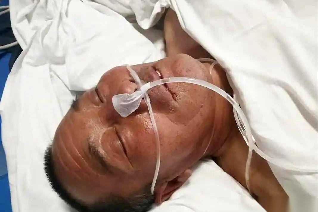 筷子突然拿不稳了，掉在桌上。想说句话，舌头却跟打了结一样，嘴里含含糊糊的。你