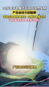 4月28日，贵州六盘水，一30岁女子剖腹产后，双眼突然失明，检查后发现是产后血栓